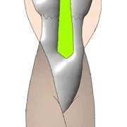 バニーガール
