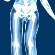 X-RAY/01 (ﾆｼﾞｴｯｸｽ)