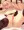 ミセル