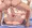 ゼルダ姫種付け