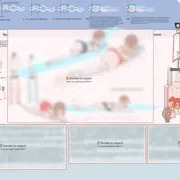 迷你裙驅動