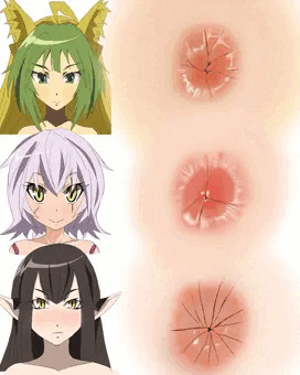 アナの練習５