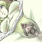 王女様子宮口から性液採取