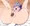 ヤマアラシちゃん