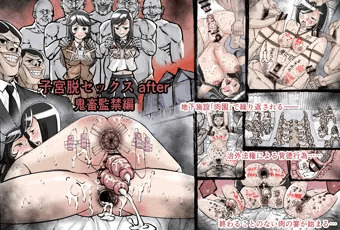 子宮脱セックス after-鬼畜監禁編-［無料版］