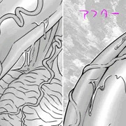 血管の描き方