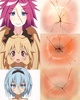 アナの練習２２