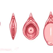 膣