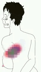 ちょいグロ