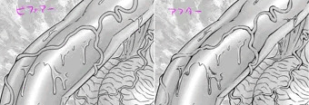 血管の描き方
