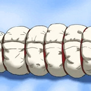 ウチのエンジェちゃんブランケットボンデージ