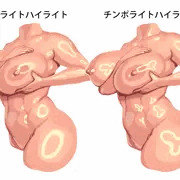 チンポラ