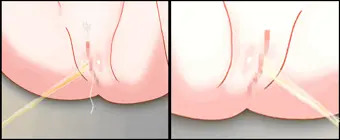 某所でアンケート行った結果のGIF
