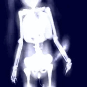 X-RAY/02 (ﾆｼﾞｴｯｸｽ)