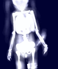 X-RAY/02 (ﾆｼﾞｴｯｸｽ)