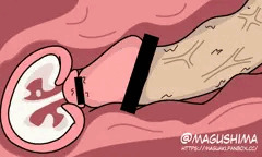 断面図