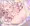 みゆちゃんほけんたいいく